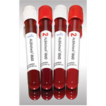 High Quality, Consistent and Economical, Simulated Whole Blood Controls